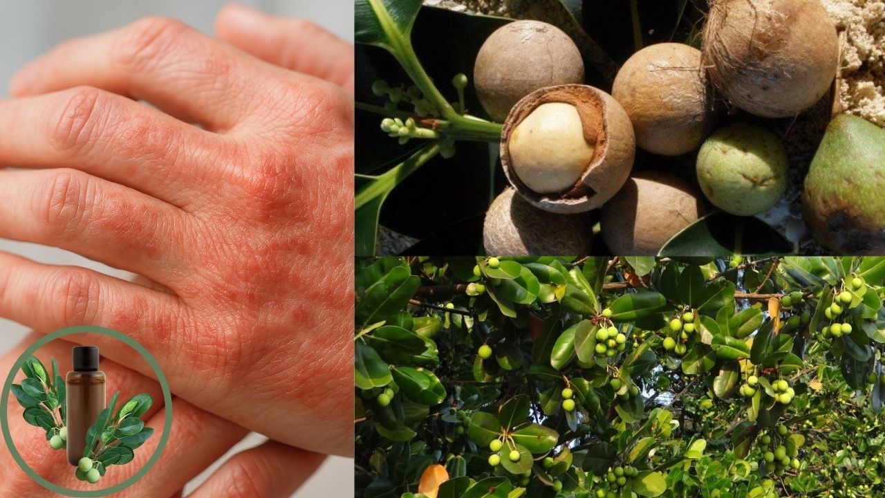 cong-dung-dau-mu-u-trong-viem-da