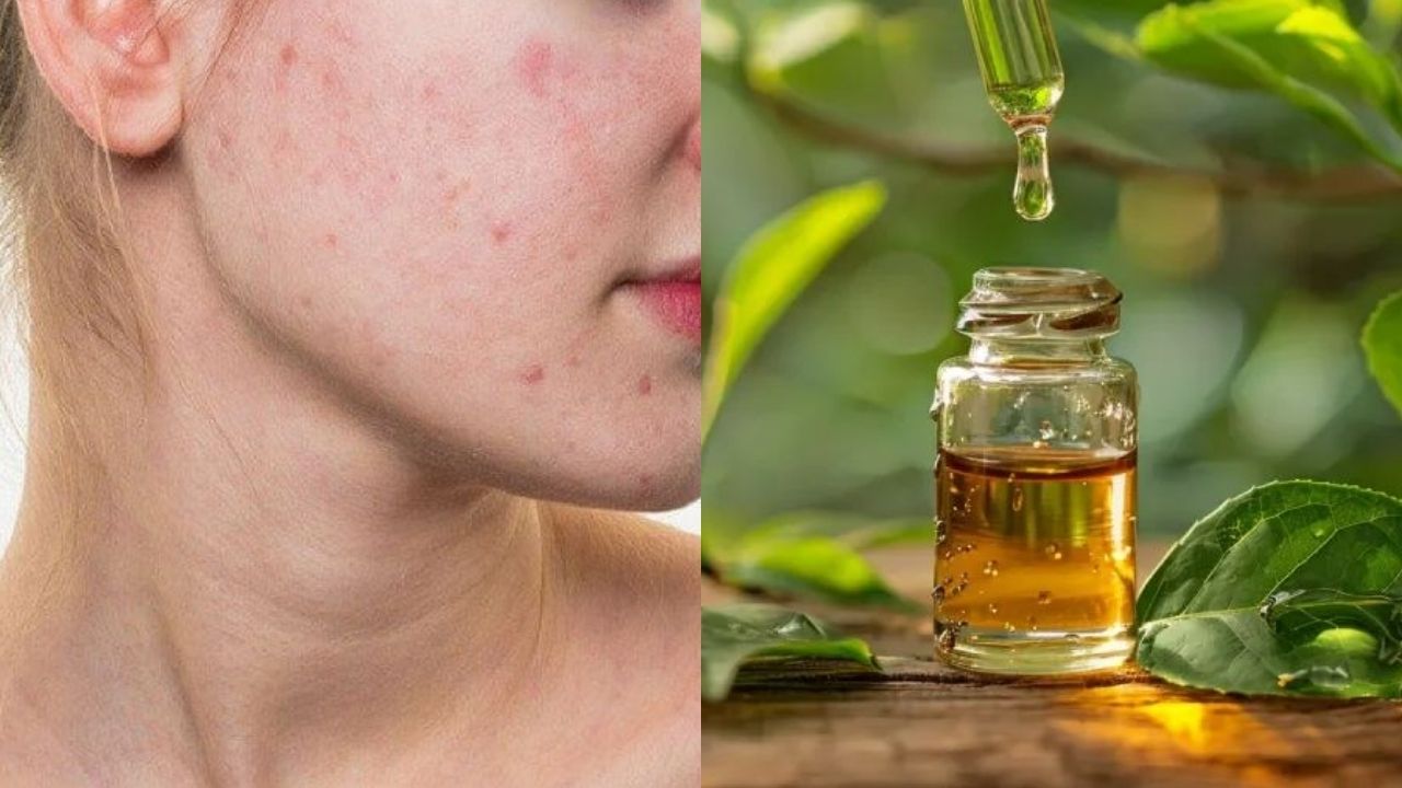 luu-y-khi-su-dung-tinh-dau-hoa-ngoc-lan